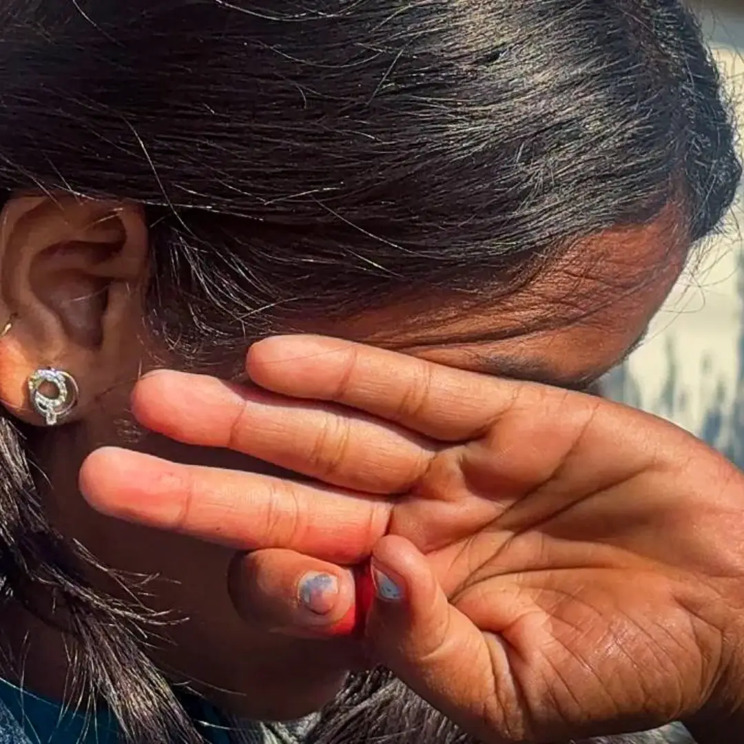 A person with long, dark hair covers their face with their hands, conveying shyness or distress. Sunlight casts shadows on their hair and a background wall.